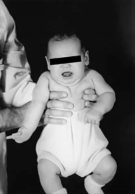 Pediatrics 2001 Practice Questions: Set 3 (Solved) - Figure 15