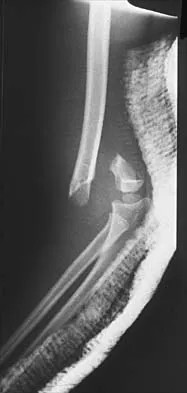 Pediatrics 2001 Practice Questions: Set 3 (Solved) - Figure 16