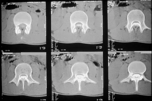 Pediatrics 2001 Practice Questions: Set 3 (Solved) - Figure 23