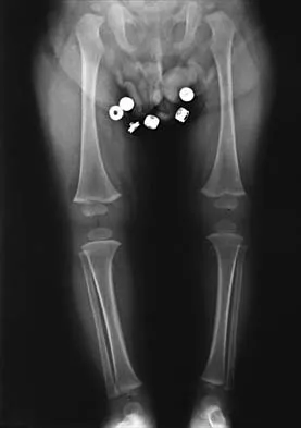 Pediatrics 2001 Practice Questions: Set 3 (Solved) - Figure 3