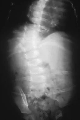 Pediatrics Board Review 2001: High-Yield MCQs (Set 4) - Figure 18