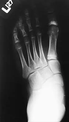 Pediatrics Board Review 2001: High-Yield MCQs (Set 4) - Figure 3