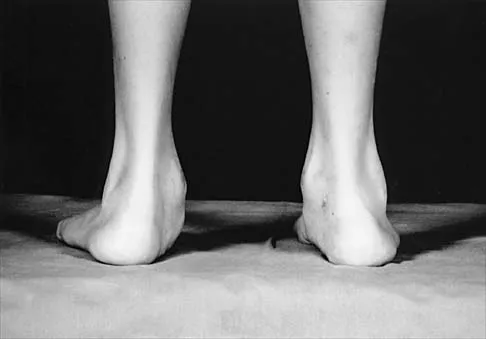 Pediatrics Board Review 2001: High-Yield MCQs (Set 4) - Figure 7