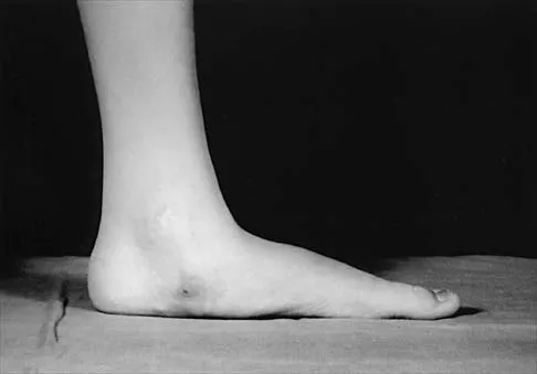 Pediatrics Board Review 2001: High-Yield MCQs (Set 4) - Figure 8