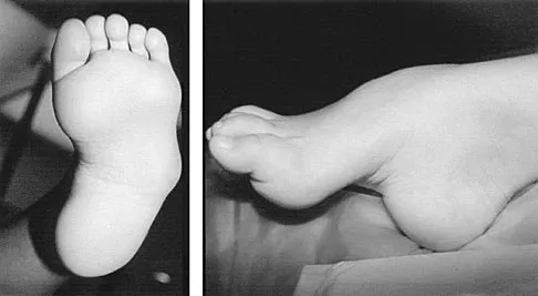 Pediatrics 2004 Practice Questions: Set 1 (Solved) - Figure 1