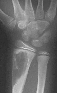Pediatrics 2004 Practice Questions: Set 1 (Solved) - Figure 10