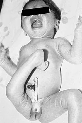 Pediatrics 2004 Practice Questions: Set 1 (Solved) - Figure 21