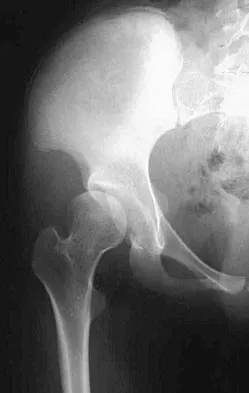 Pediatrics 2004 Practice Questions: Set 1 (Solved) - Figure 26