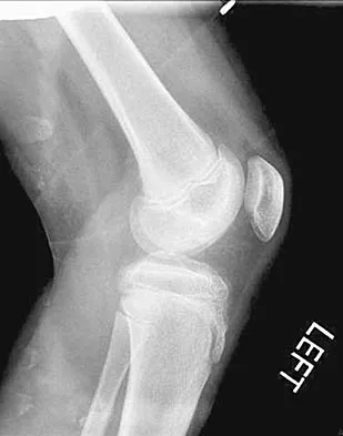 Pediatrics 2004 Practice Questions: Set 1 (Solved) - Figure 4