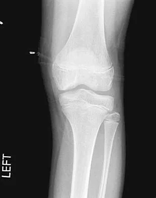 Pediatrics 2004 Practice Questions: Set 1 (Solved) - Figure 6