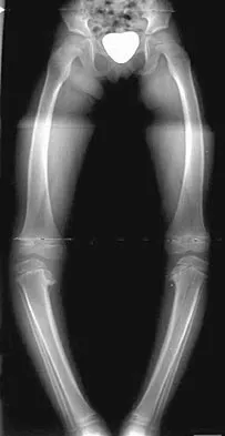 Pediatrics 2004 Practice Questions: Set 1 (Solved) - Figure 7