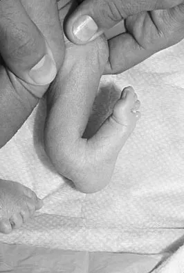 Pediatrics Board Review 2004: High-Yield MCQs (Set 2) - Figure 1