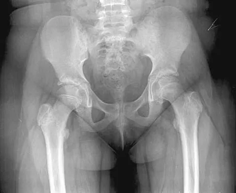 Pediatrics Board Review 2004: High-Yield MCQs (Set 2) - Figure 10