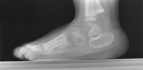 Pediatrics Board Review 2004: High-Yield MCQs (Set 2) - Figure 17