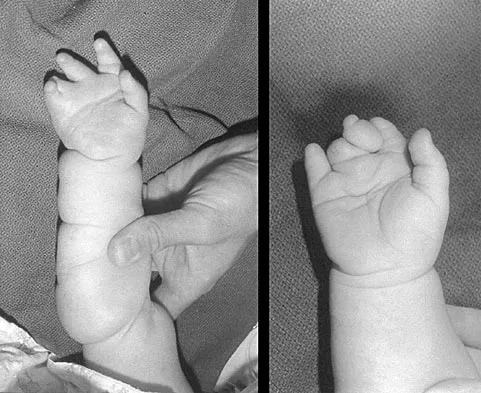 Pediatrics Board Review 2004: High-Yield MCQs (Set 2) - Figure 20