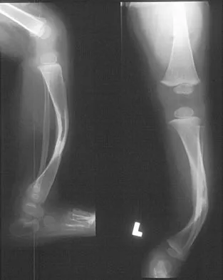Click to enlarge Pediatrics Board Review 2004: High-Yield MCQs (Set 2) - Figure 23