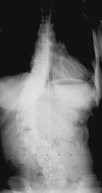 Pediatrics Board Review 2004: High-Yield MCQs (Set 2) - Figure 24