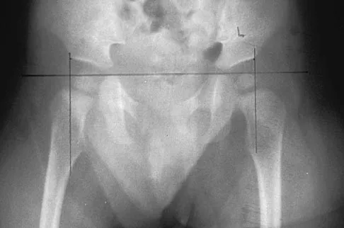 Pediatrics Board Review 2004: High-Yield MCQs (Set 2) - Figure 25