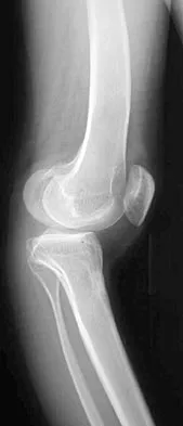 Pediatrics Board Review 2004: High-Yield MCQs (Set 2) - Figure 3