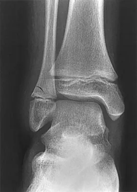 Pediatrics Board Review 2004: High-Yield MCQs (Set 2) - Figure 4