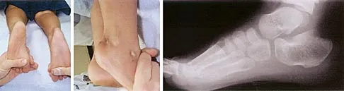 Pediatrics Board Review 2004: High-Yield MCQs (Set 2) - Figure 9