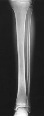 Pediatrics 2004 Practice Questions: Set 3 (Solved) - Figure 12