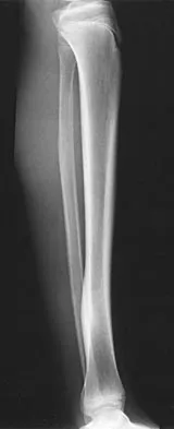 Pediatrics 2004 Practice Questions: Set 3 (Solved) - Figure 13