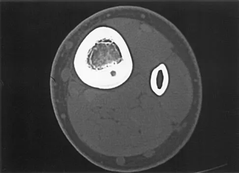 Pediatrics 2004 Practice Questions: Set 3 (Solved) - Figure 14