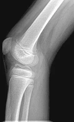 Pediatrics 2004 Practice Questions: Set 3 (Solved) - Figure 19