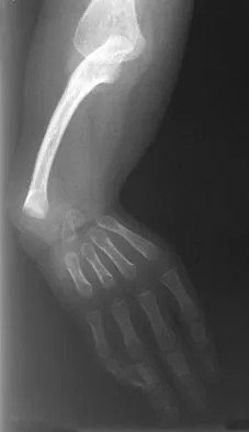 Pediatrics 2004 Practice Questions: Set 3 (Solved) - Figure 21