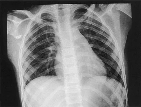 Pediatrics 2004 Practice Questions: Set 3 (Solved) - Figure 26