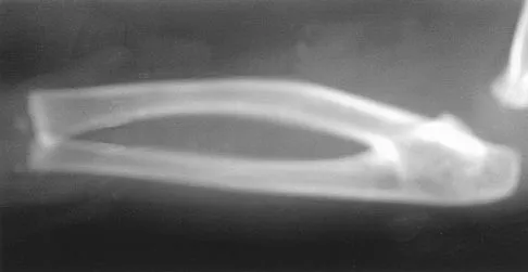 Pediatrics Board Review 2004: High-Yield MCQs (Set 4) - Figure 1