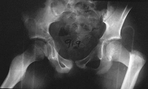 Pediatrics Board Review 2004: High-Yield MCQs (Set 4) - Figure 4