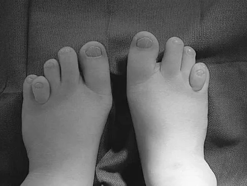 Pediatrics Board Review 2004: High-Yield MCQs (Set 4) - Figure 5