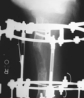 Pediatrics Board Review 2004: High-Yield MCQs (Set 4) - Figure 7