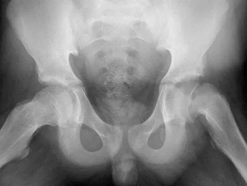 Pediatrics Board Review 2004: High-Yield MCQs (Set 4) - Figure 8