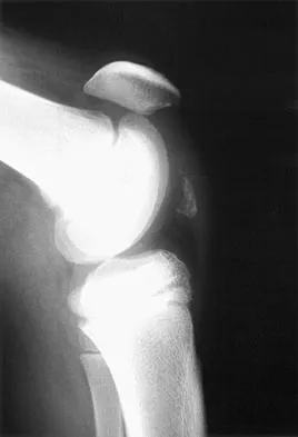 Pediatrics 2007 Practice Questions: Set 1 (Solved) - Figure 20