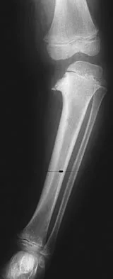 Pediatrics 2007 Practice Questions: Set 1 (Solved) - Figure 24