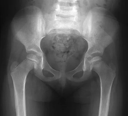 Pediatrics Board Review 2007: High-Yield MCQs (Set 2) - Figure 1