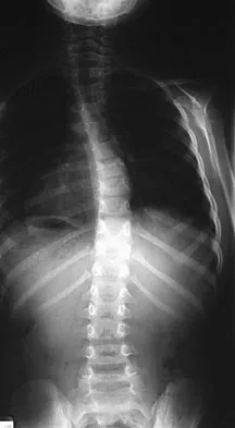 Pediatrics Board Review 2007: High-Yield MCQs (Set 2) - Figure 13