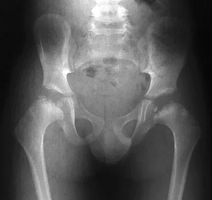 Pediatrics Board Review 2007: High-Yield MCQs (Set 2) - Figure 16
