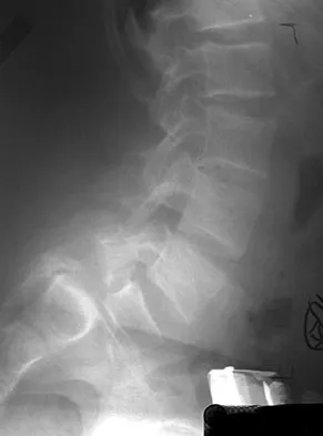 Pediatrics Board Review 2007: High-Yield MCQs (Set 2) - Figure 19