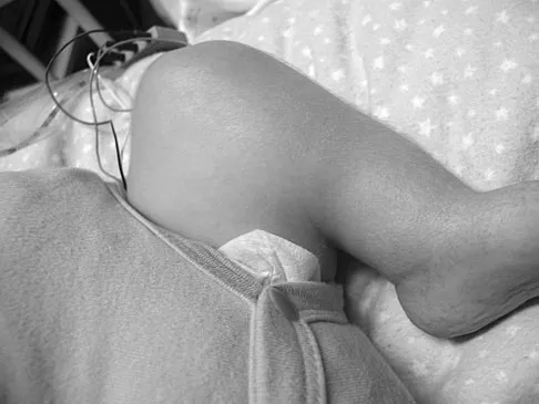 Pediatrics Board Review 2007: High-Yield MCQs (Set 2) - Figure 20