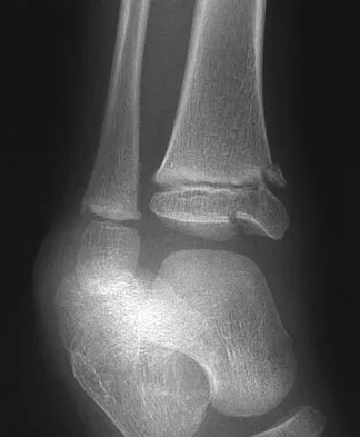 Pediatrics Board Review 2007: High-Yield MCQs (Set 2) - Figure 23