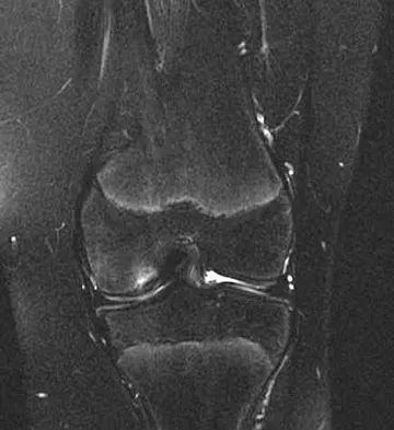 Pediatrics Board Review 2007: High-Yield MCQs (Set 2) - Figure 6
