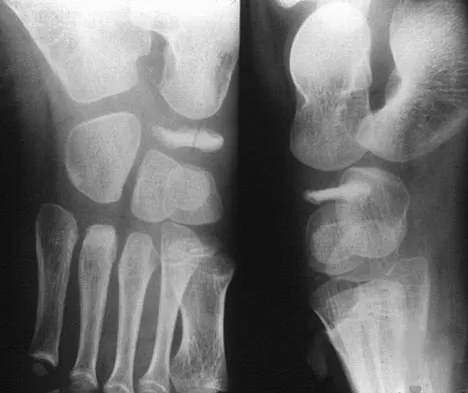 Pediatrics 2007 Practice Questions: Set 3 (Solved) - Figure 13