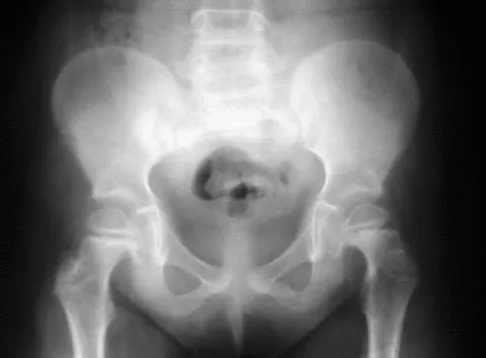 Pediatrics Board Review 2007: High-Yield MCQs (Set 4) - Figure 10