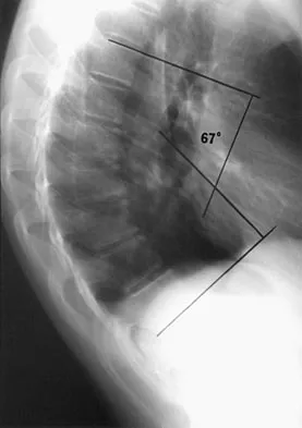 Pediatrics Board Review 2007: High-Yield MCQs (Set 4) - Figure 13
