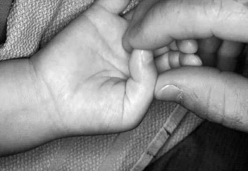 Pediatrics Board Review 2007: High-Yield MCQs (Set 4) - Figure 15