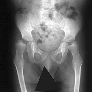 Pediatrics Board Review 2007: High-Yield MCQs (Set 4) - Figure 2